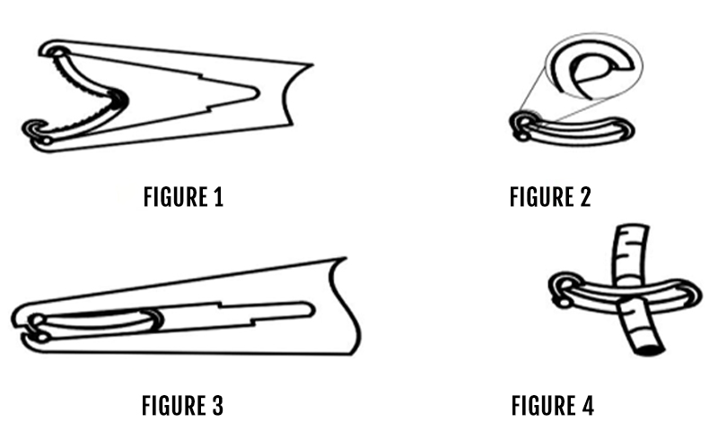 Disposable-tissue-closure-clamp-How-to-use