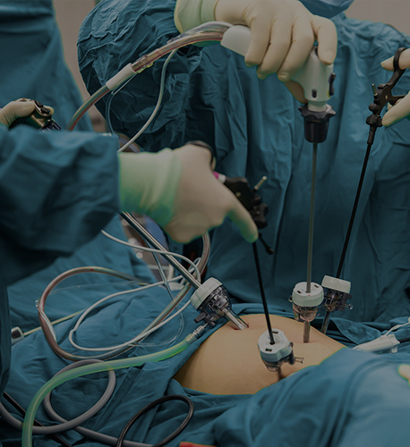 Laparoscopic Surgical Instruments